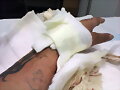 Asi Tengo La Mano