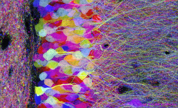 Peering into the micro world