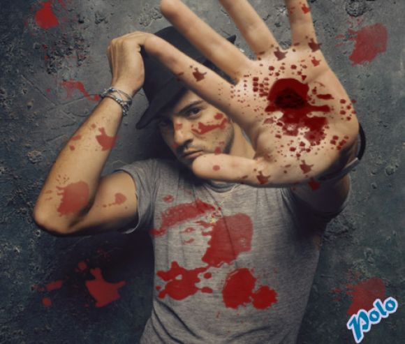 David Bisbla mano destrozada