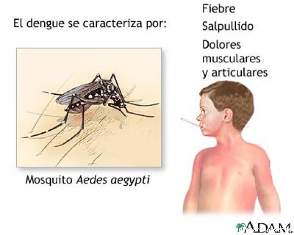 Dengue