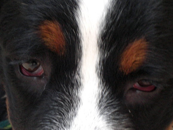 Conjuntivitis