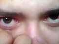 claro/oscuro