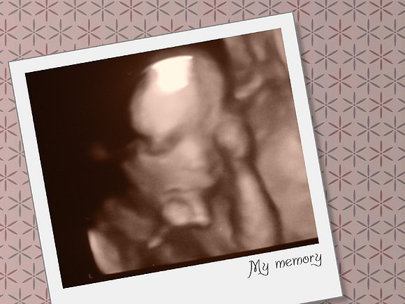 Samuel, mi bebé de 20 semanas