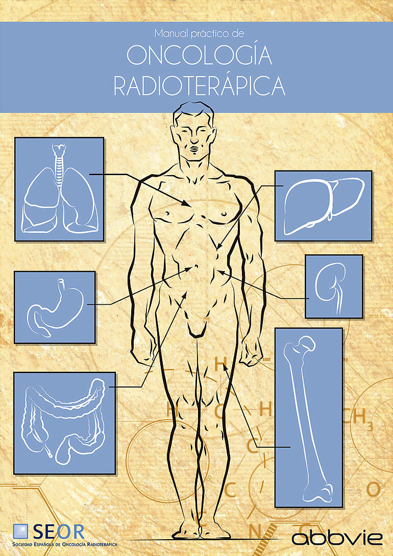 oncologia radioterapia